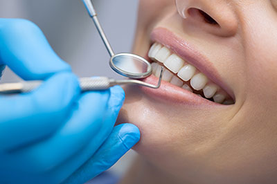 Dental Checkups in Rocklin