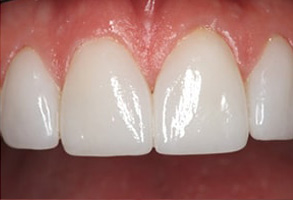 Dental Photos in Rocklin